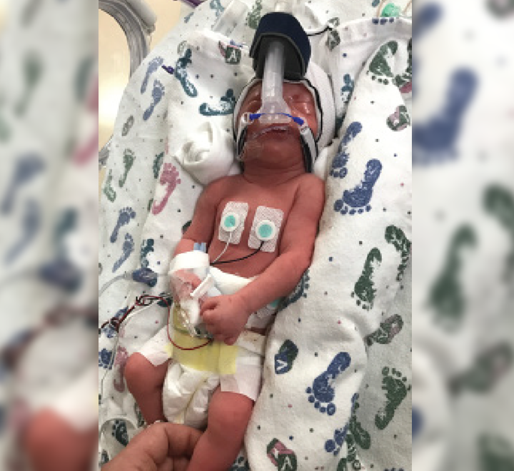 you-baby-with-breathing-tube