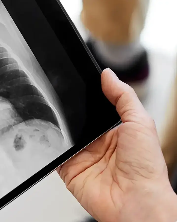 people reviewing chest x-ray