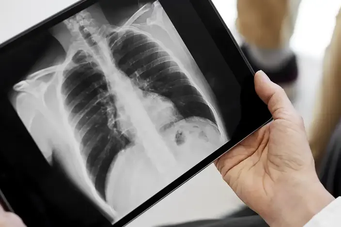 chest x-ray reviewed by doctor