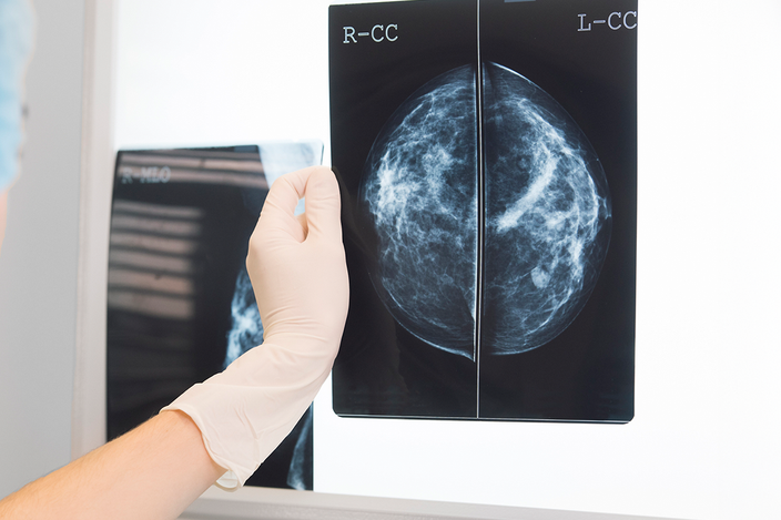 Woman-reviewing-mammogram