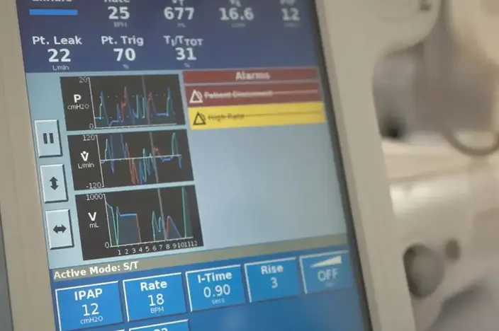 monitor showing vital signs