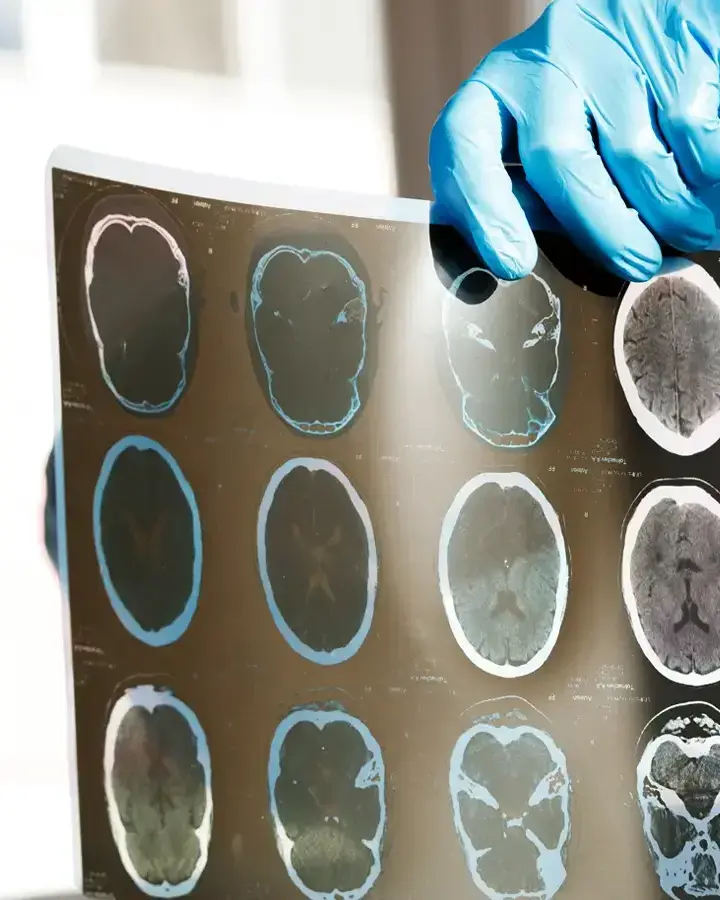 a man in a lab coat and gloves holds up a mri