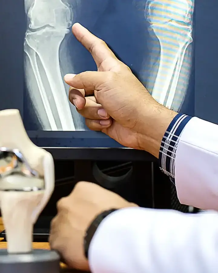 doctor with x-ray and plastic joint models