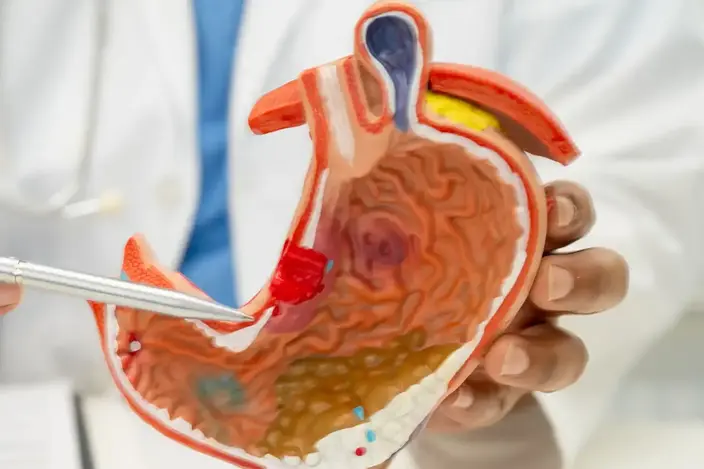 doctor holding model of stomach